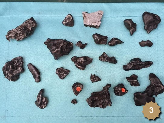 Meteoritos por unidad